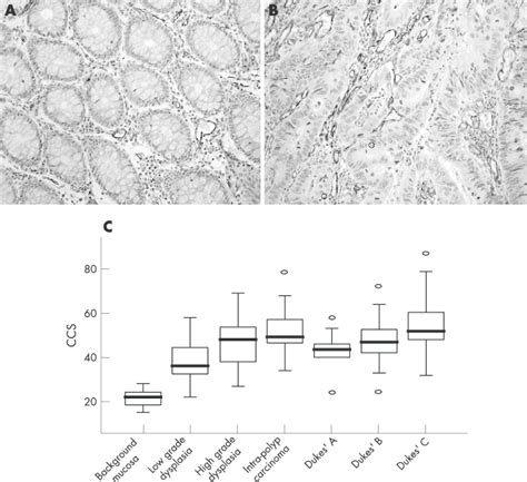 Microvessel Density Across The Adenomacarcinoma Sequence