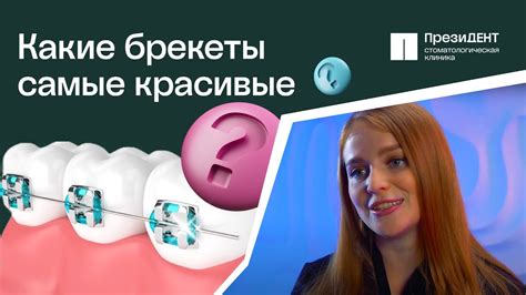 👄 Брекеты: какие виды, в чем разница, как устанавливают? Брекеты виды и ...