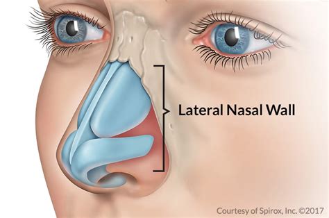 Nasal Vault Anatomy