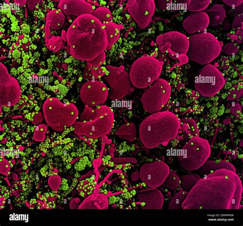 Colorized Scanning Electron Micrograph Of An Apoptotic Cell Pink