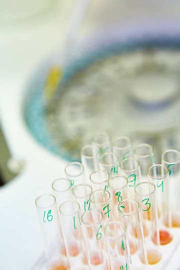 Abstract Scientific Background Of Pipette Dropping Sample Into A Test