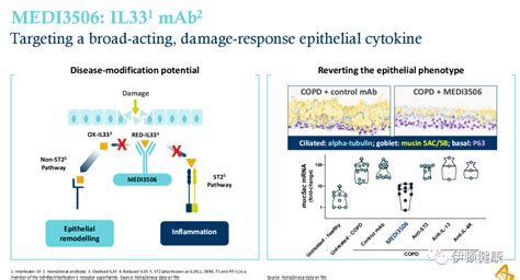 慢阻肺新药临床开展美国阿斯利康研发新靶点药物 伊顿健康