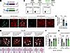 Jci Endothelium Derived Semaphorin G Attenuates Ischemic Retinopathy