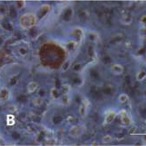 Adipogenic And Osteogenic Differentiation Of UC MSCs Scale