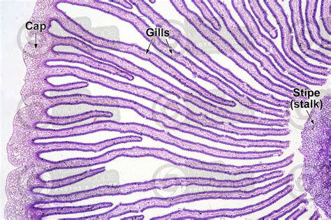 Basidiomycota Slide Labeled