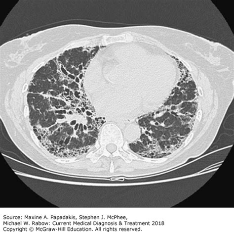 CMDT Media Library | AccessMedicine | McGraw-Hill Medical