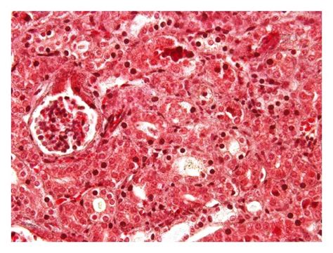 Renal Fibrosis By Massons Trichrome Staining At Day Of A Control