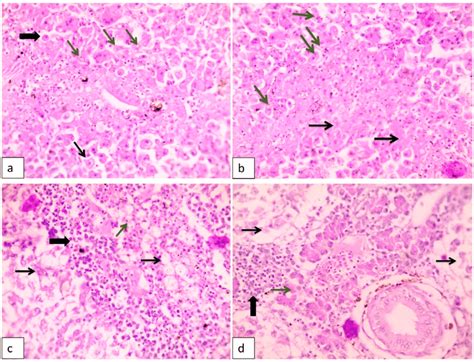 Histopathological Lesions In Liver Of Naturally Diseased Nile Tilapia