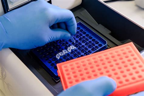 Antibodyhybridoma Sequencing