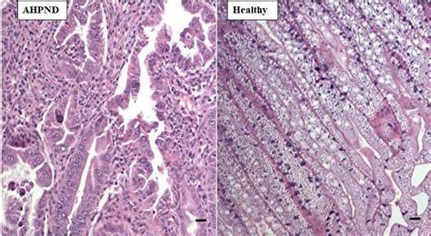 Ahpnd Affected Vs Healthy Shrimp Histological Examination Of The Hp Of Download Scientific