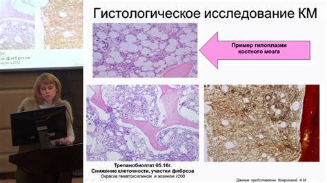 Современная гематология. Проблемы и решения. (часть 6) - YouTube