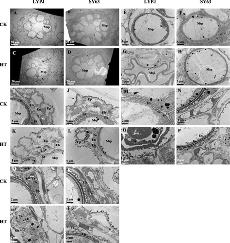 Transmission Electron Micrographs Of Anthers At Stage In Lypj And