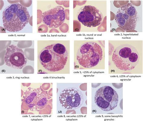 Eosinophiles Bas