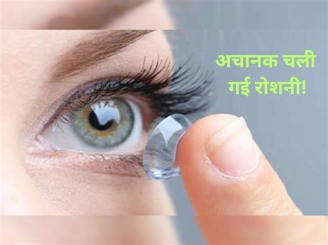 Man Lost Eyesight Sleeps With Contact Lenses Parasites Starts Eat Eye In Florida आंख में ऐसी चीज