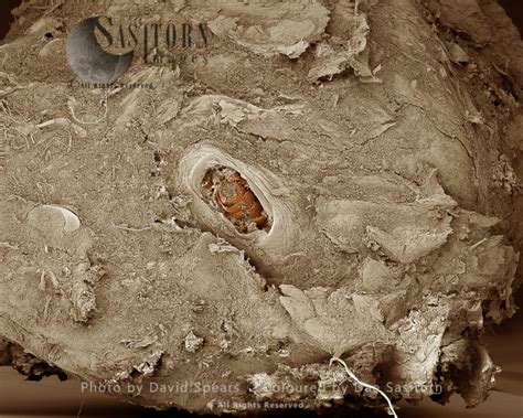 Sem Chigoe Flea Tunga Penetrans Magnification X 70 At A4 Print Size