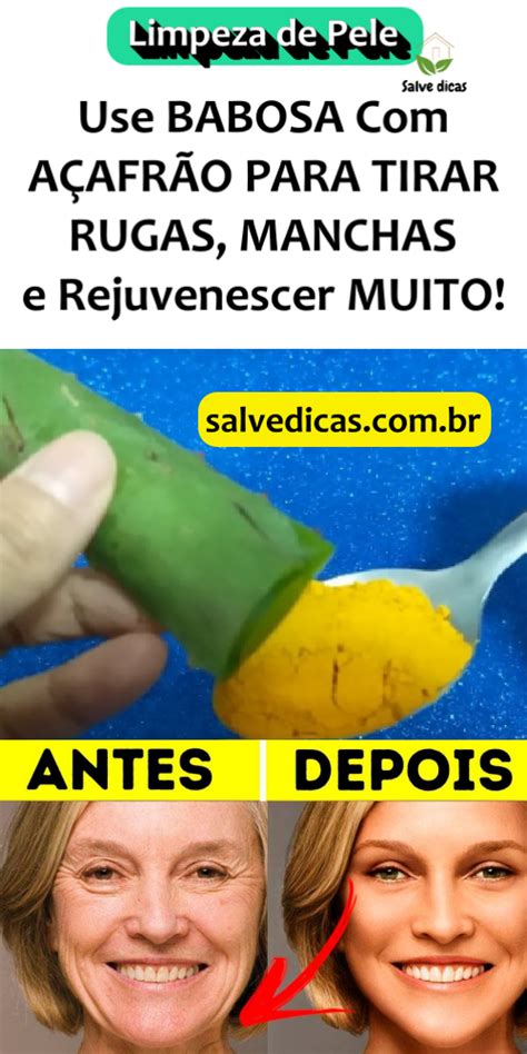 Use Babosa A Afr O Para Tirar Rugas Manchas E Rejuvenescer Muito