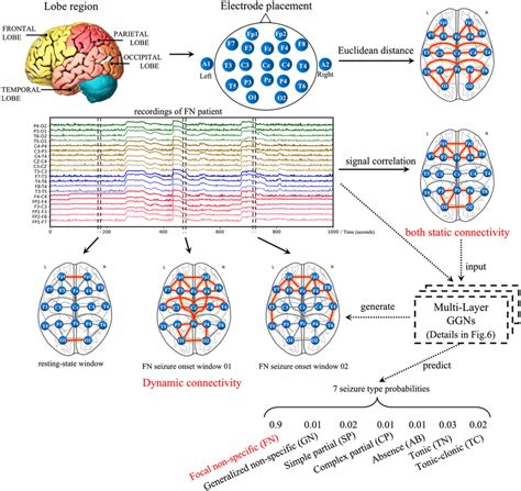 The Key Concept Of Scalp Eeg Based Framework For Automated Detection Of