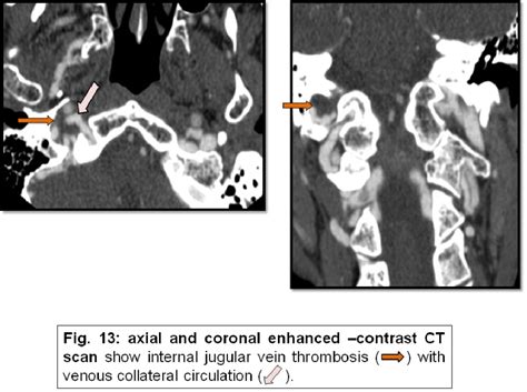 Figure 1 From Pictorial Review Of The Imaging Anatomy And Common