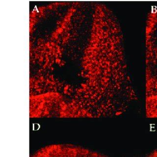 DAPI Staining And Cyclin A Expression In Usp Clones Each Row Of