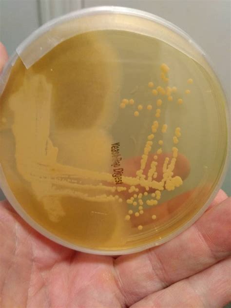 Contaminated Streak Plate