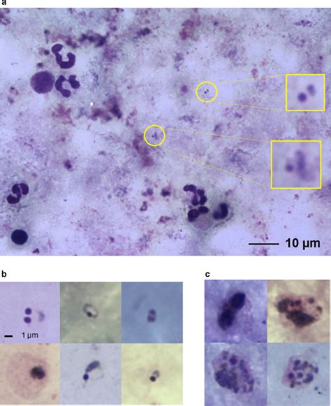 Typical Thick Film Microscope Images A A Field Of View Image Download Scientific Diagram