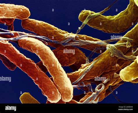 Cholera Bacteria Coloured Scanning Electron Micrograph SEM Of Vibrio