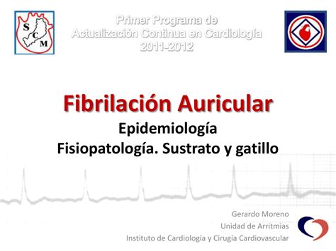 Fibrilaci N Auricular Epidemiolog A Fisiopatolog A Sustrato Y