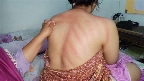 Kerokan Wanita Punggung Masuk Angin Faikalkn Mbak