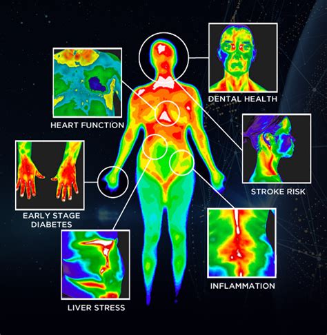 Medical Thermal Imaging Psy Tek Labs