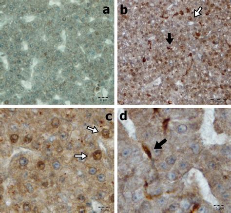 Caspase 3 Expression In The Liver Sections From Control And