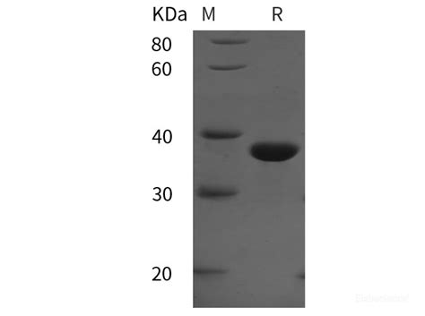 Quality Reliable Recombinant Human Pcna Protein His Tag Pdeh At