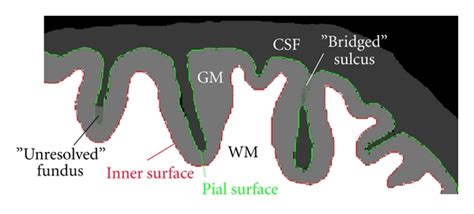 Schematic Illustration Of A Fragment Of Brain Slice Contours Of The