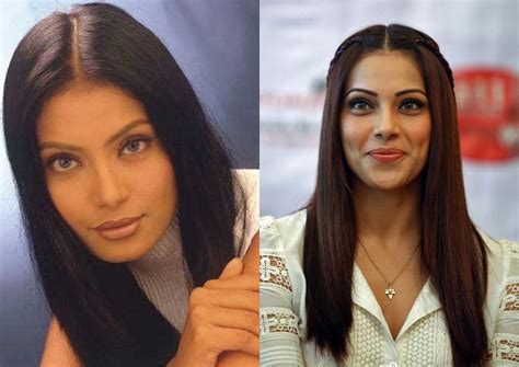 Bollywood Actresses Who Went Under The Knife To Become Gorgeous