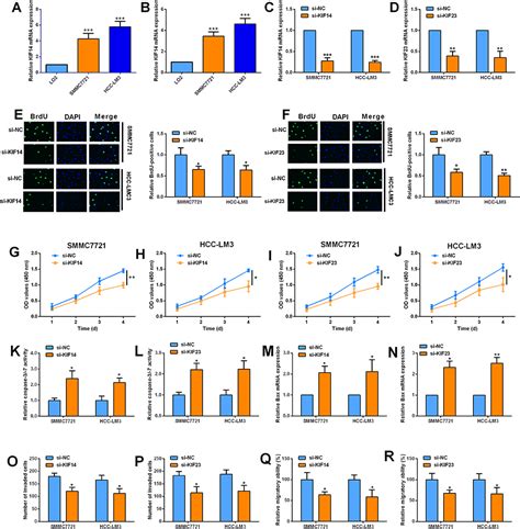 KIF14 And KIF23 Promote Cell Proliferation And Chemoresistance In HCC