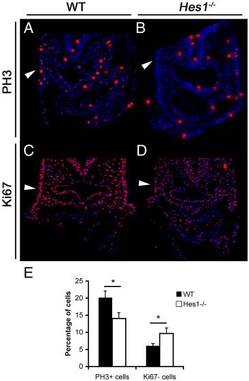 Proliferation Defect In Hes1 Mutants Ab Immunohistochemistry With