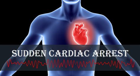 Why Does Sudden Cardiac Arrest Occur