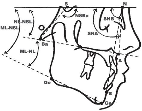 Figure 1 From Cephalometric Floating Norms For Czech Adults Semantic Scholar