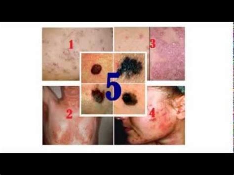 Common Skin Diseases And Disorders Youtube