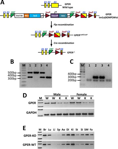 Cardiomyocyte Specific Deletion Of The G Protein Coupled Estrogen