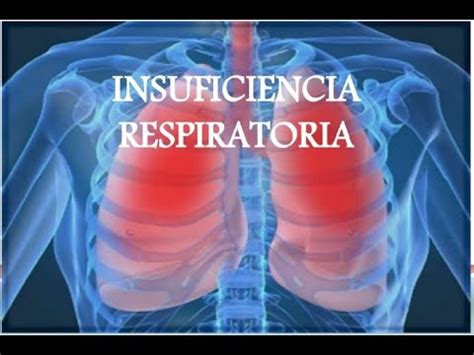 Fisioterapia Insuficiencia Respiratoria Youtube