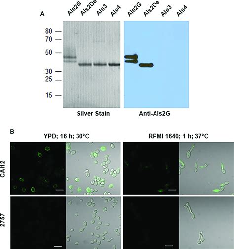 Western Blotting And Immunolabeling Of C Albicans Cells To Demonstrate