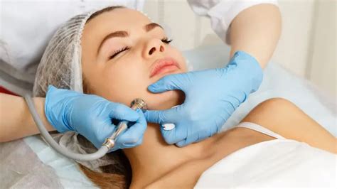 Microdermabrasion Remove Dark Spots For Acne Scars