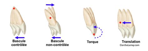 Movement Of Teeth In The Bone And Gingiva