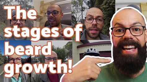 Growing A Beard Stages With Pictures Every Embarrassing Stage With