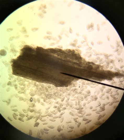 Protista Cells Under Microscope Protists Microscope Slides