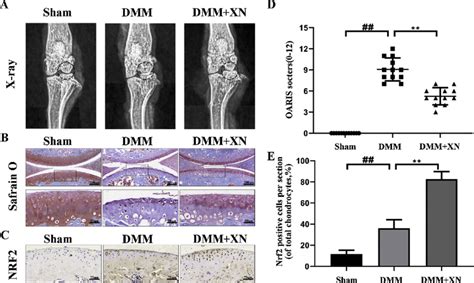 Xn Improves The Advancement Of Oa In The Dmm Mouse Model In Vivo