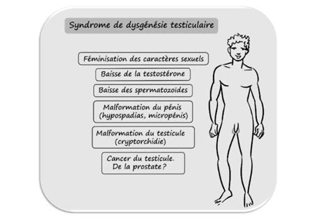 Syndrome De Dysgénésie Testiculaire Testicular Dysgenesis Syndrome