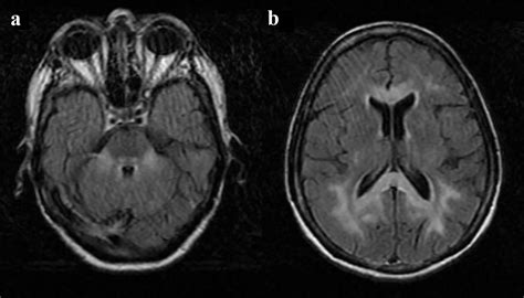 J Med Cases