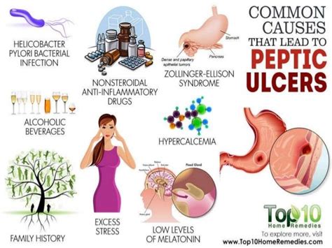 Peptic Ulcer Disease