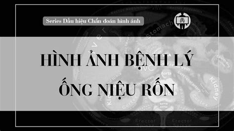 Hình ảnh Các Bệnh Của ống Niệu Rốn Hình ảnh Y Khoa Chẩn đoán Hình